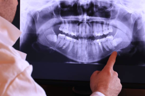 Best Knocked-Out Tooth Emergency  in Mont Clare, PA