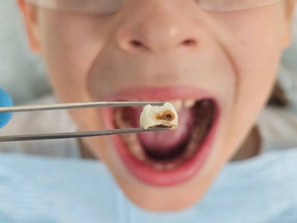 Best Urgent Tooth Repair  in Mont Clare, PA